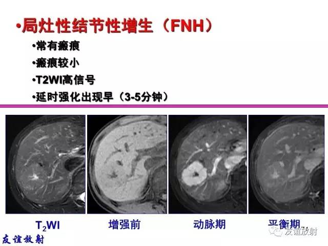 【PPT】基本病变的MRI信号分析：水肿、坏死、纤维化