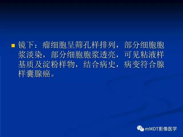 【PPT】头颈部腺样囊性癌的影像学表现