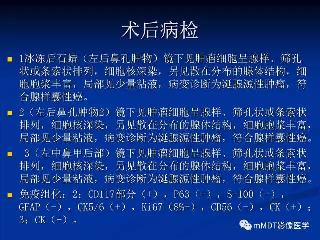 【PPT】头颈部腺样囊性癌的影像学表现