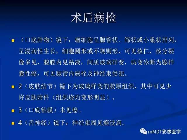 【PPT】头颈部腺样囊性癌的影像学表现