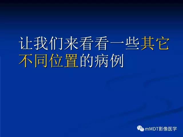 【PPT】头颈部腺样囊性癌的影像学表现