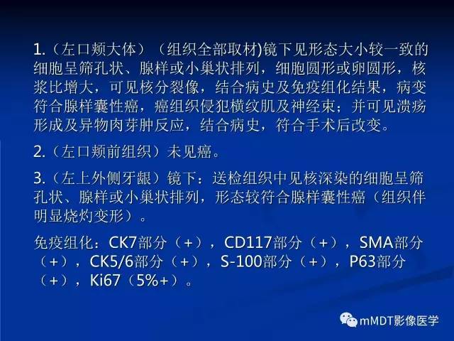 【PPT】头颈部腺样囊性癌的影像学表现