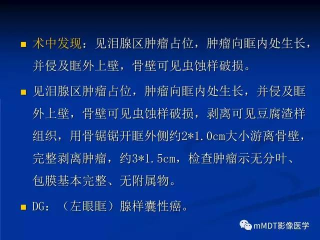 【PPT】头颈部腺样囊性癌的影像学表现
