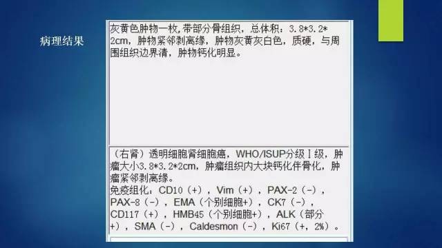 【病例】右肾透明细胞肾细胞癌伴大量钙化1例CT及MR
