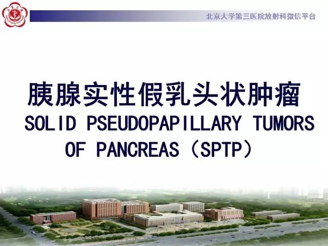 【病例】胰腺实性假乳头状瘤1例CT及MR