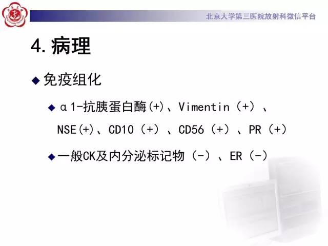 【病例】胰腺实性假乳头状瘤1例CT及MR