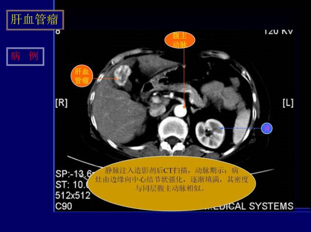 【PPT】常见肝胆胰腺疾病的CT(全)