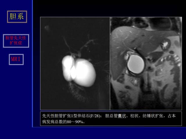 【PPT】常见肝胆胰腺疾病的CT(全)