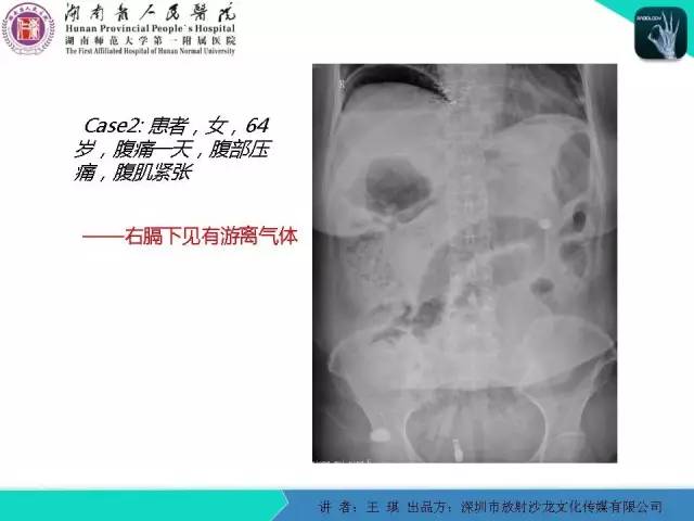 【PPT】急诊放射影像检查新变化——胸腹篇