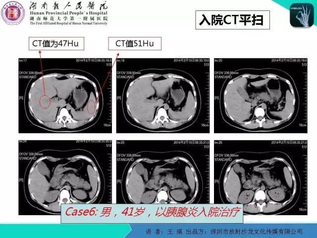 【PPT】急诊放射影像检查新变化——胸腹篇