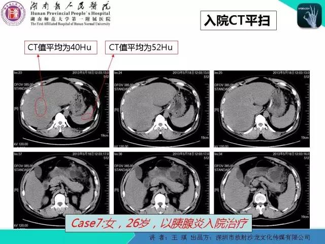【PPT】急诊放射影像检查新变化——胸腹篇