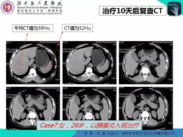 【PPT】急诊放射影像检查新变化——胸腹篇