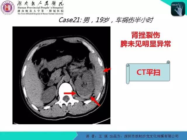 【PPT】急诊放射影像检查新变化——胸腹篇