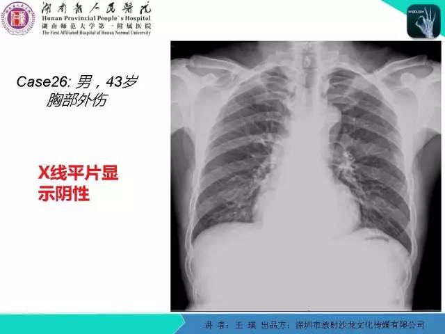 【PPT】急诊放射影像检查新变化——胸腹篇