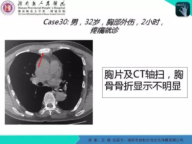 【PPT】急诊放射影像检查新变化——胸腹篇