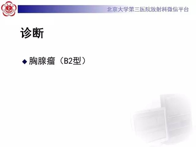 【病例】前纵隔肿瘤3例CT影像诊断