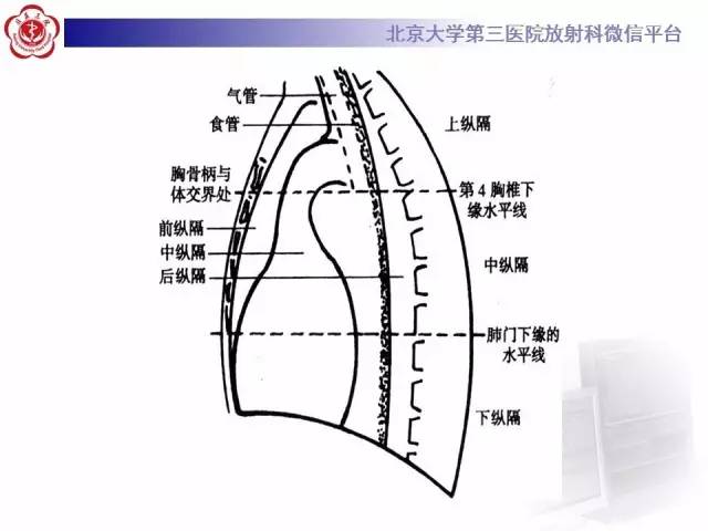 【病例】前纵隔肿瘤3例CT影像诊断