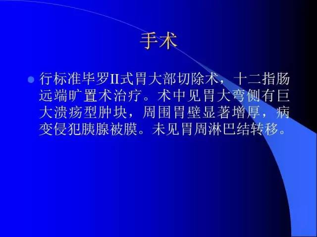 【病例】胃窦溃疡型癌肉瘤1例CT影像表现 【病例】胃窦溃疡型癌肉瘤1例CT影像表现