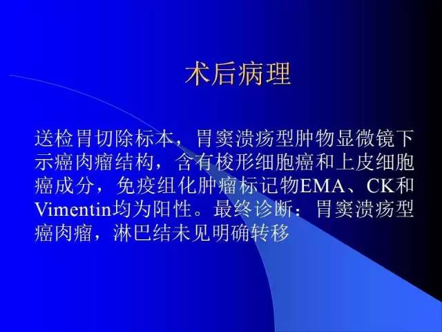 【病例】胃窦溃疡型癌肉瘤1例CT影像表现 【病例】胃窦溃疡型癌肉瘤1例CT影像表现