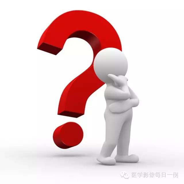 【病例】内耳Mondini畸形1例CT及MR影像表现
