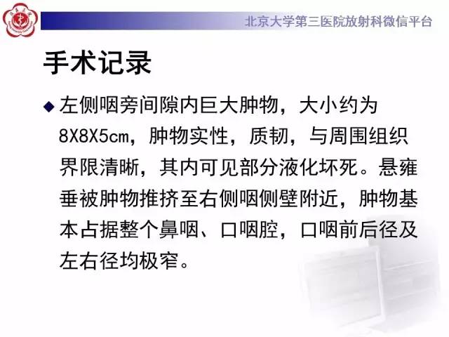【病例】咽旁间隙多形性腺瘤1例MR