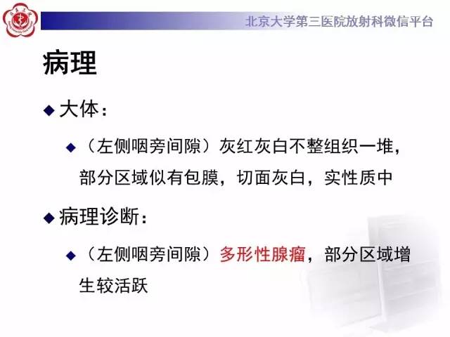 【病例】咽旁间隙多形性腺瘤1例MR