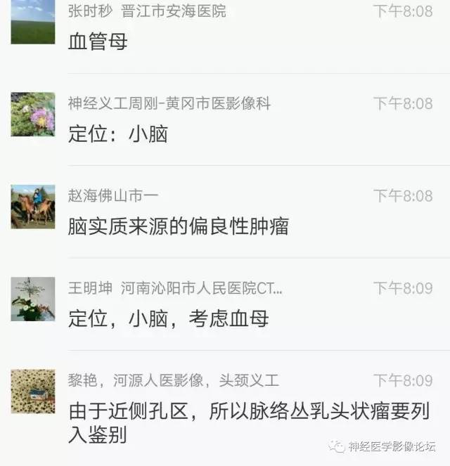 【病例】右侧小脑半球血管母细胞瘤1例CT及MR影像讨论