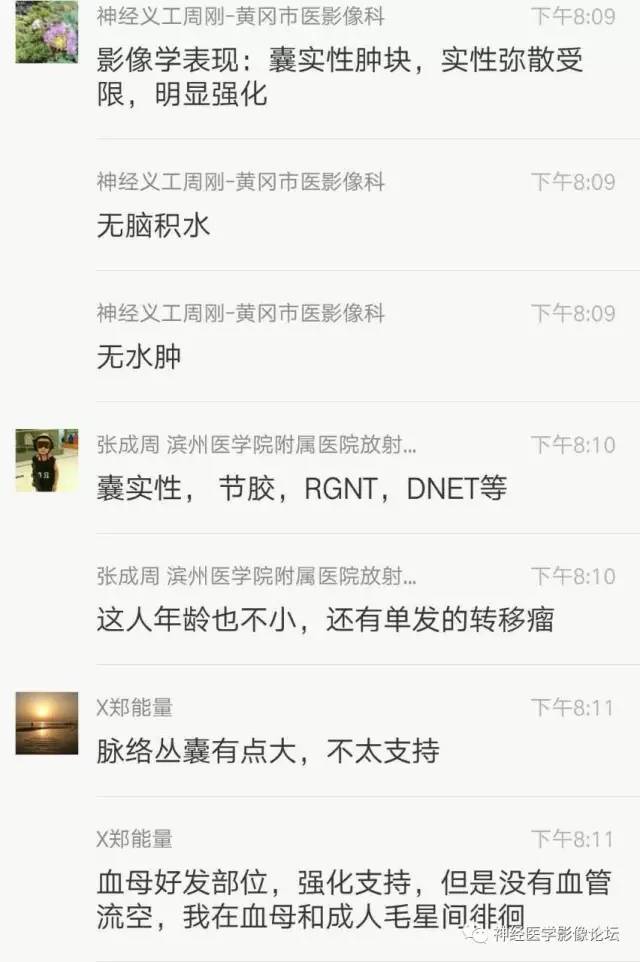 【病例】右侧小脑半球血管母细胞瘤1例CT及MR影像讨论