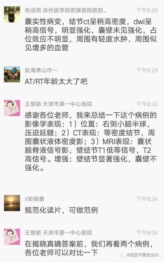 【病例】右侧小脑半球血管母细胞瘤1例CT及MR影像讨论