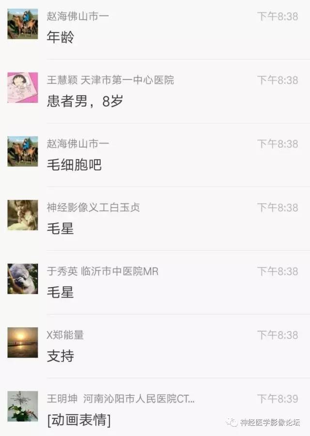 【病例】右侧小脑半球血管母细胞瘤1例CT及MR影像讨论