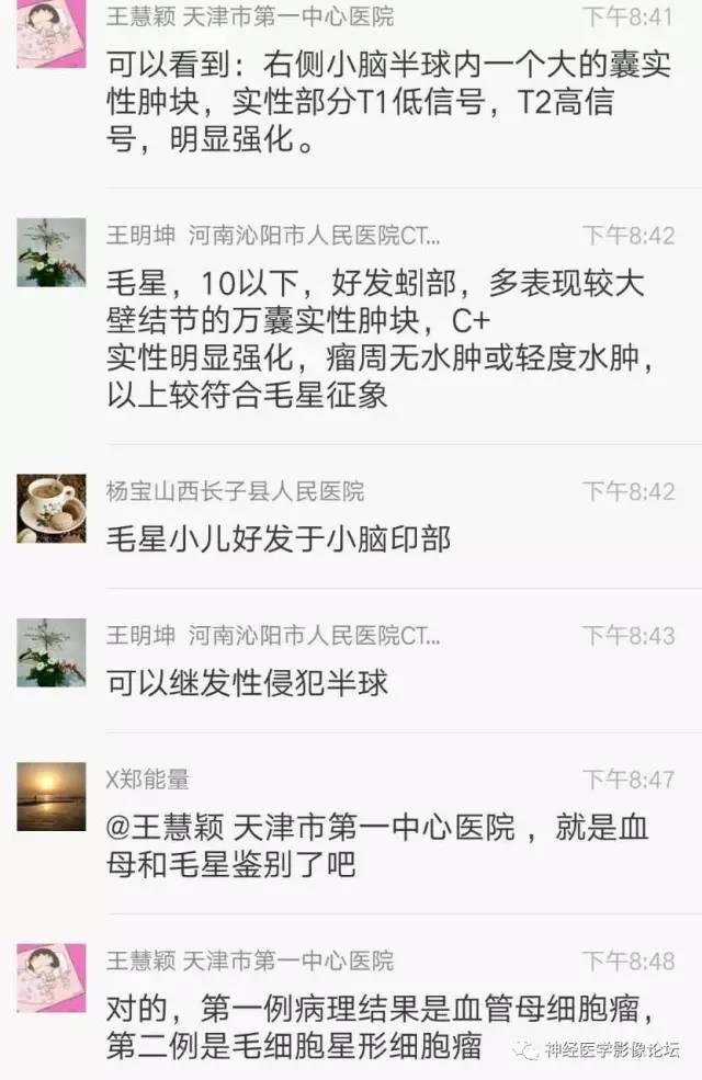 【病例】右侧小脑半球血管母细胞瘤1例CT及MR影像讨论