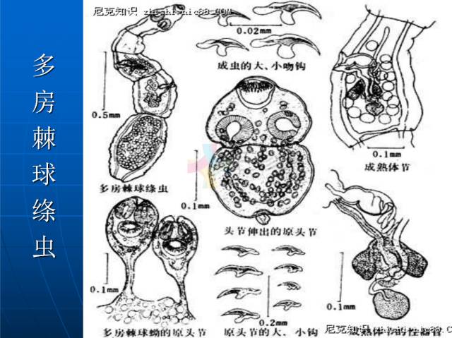 【PPT】肝包虫CT诊断
