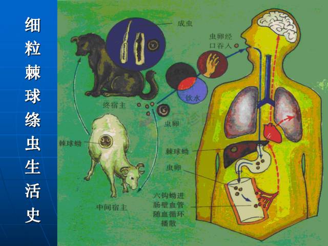 【PPT】肝包虫CT诊断