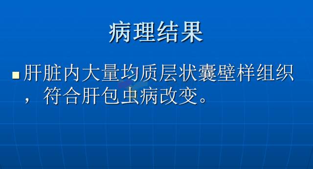 【PPT】肝包虫CT诊断