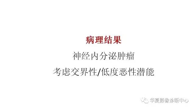 【病例】胰腺神经内分泌肿瘤1例CT影像表现