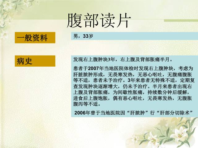 【病例】肝滤泡树突细胞肉瘤1例CT影像表现