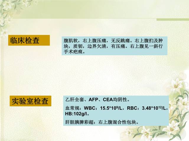 【病例】肝滤泡树突细胞肉瘤1例CT影像表现