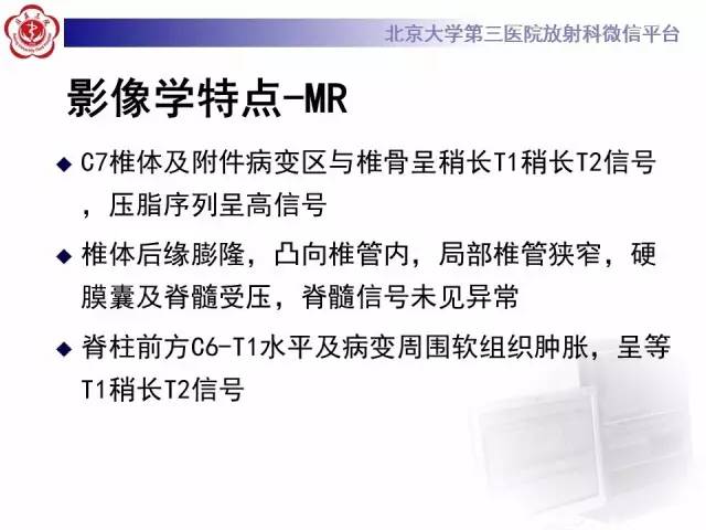 【病例】颈椎朗格汉斯组织细胞增生症1例CT及MR影像诊断