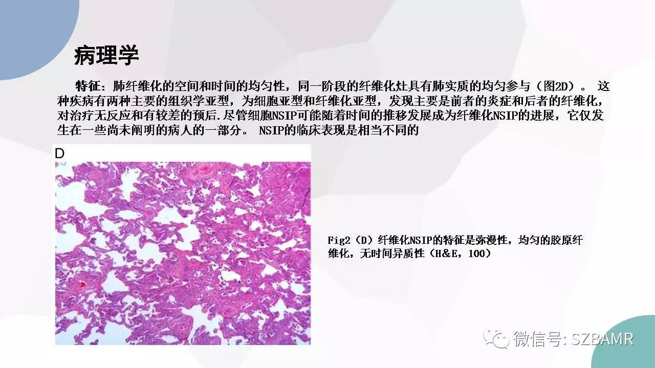 【PPT】特发性间质性肺炎的影像与病理