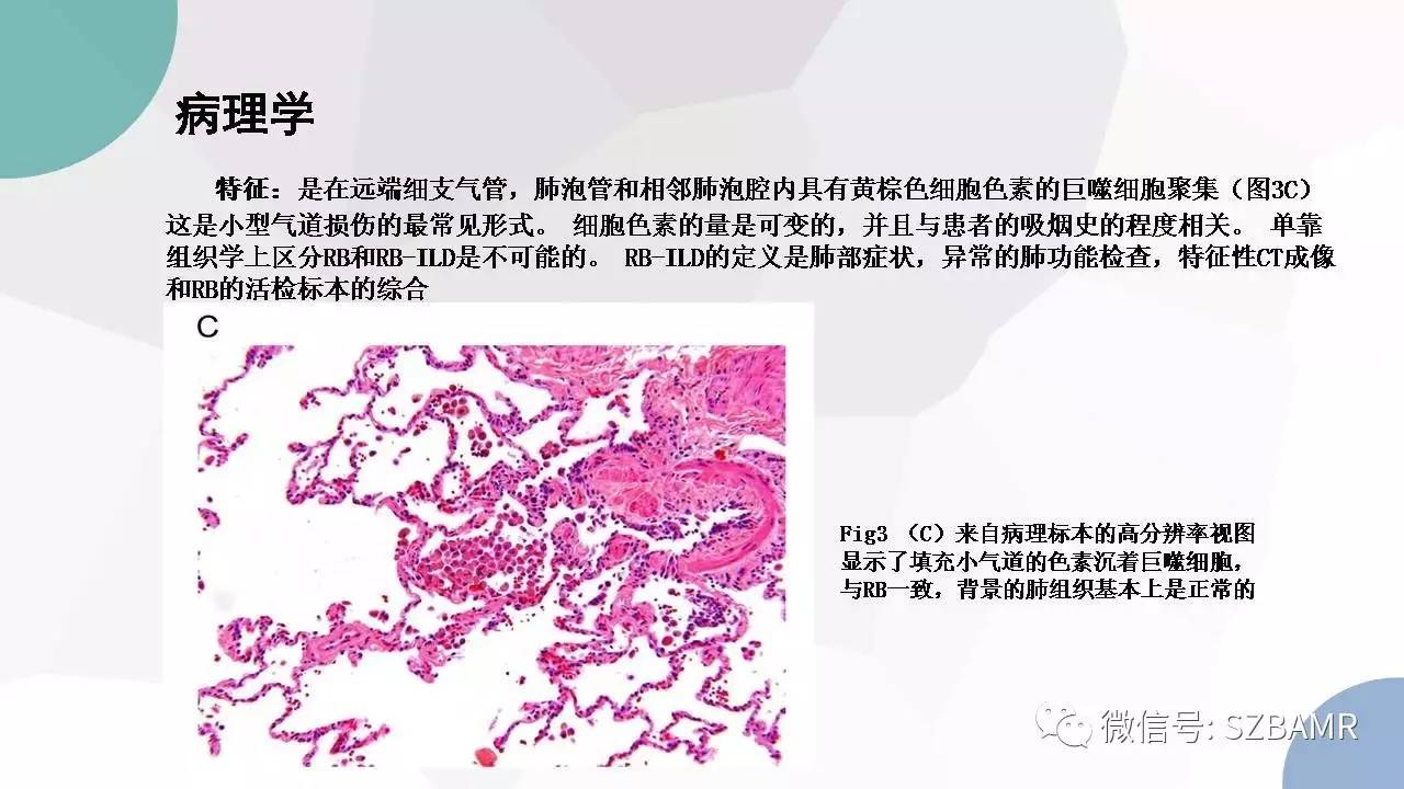 【PPT】特发性间质性肺炎的影像与病理