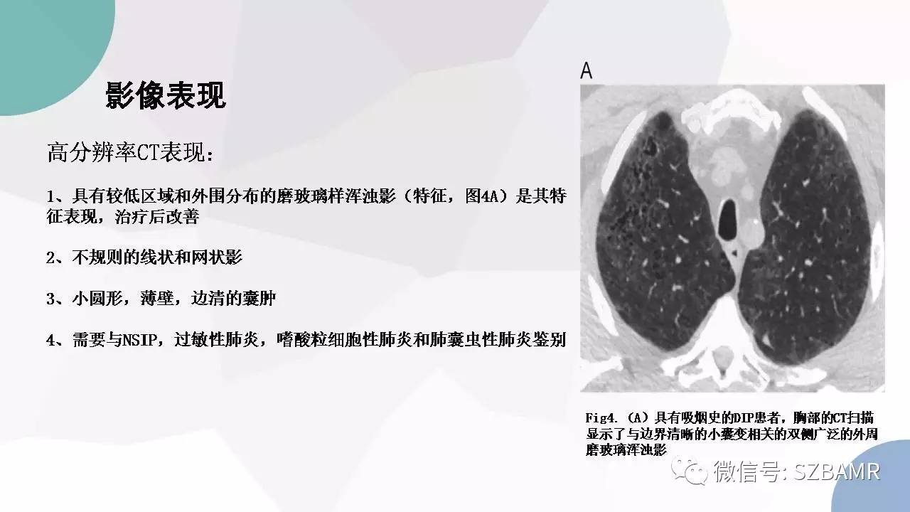 【PPT】特发性间质性肺炎的影像与病理