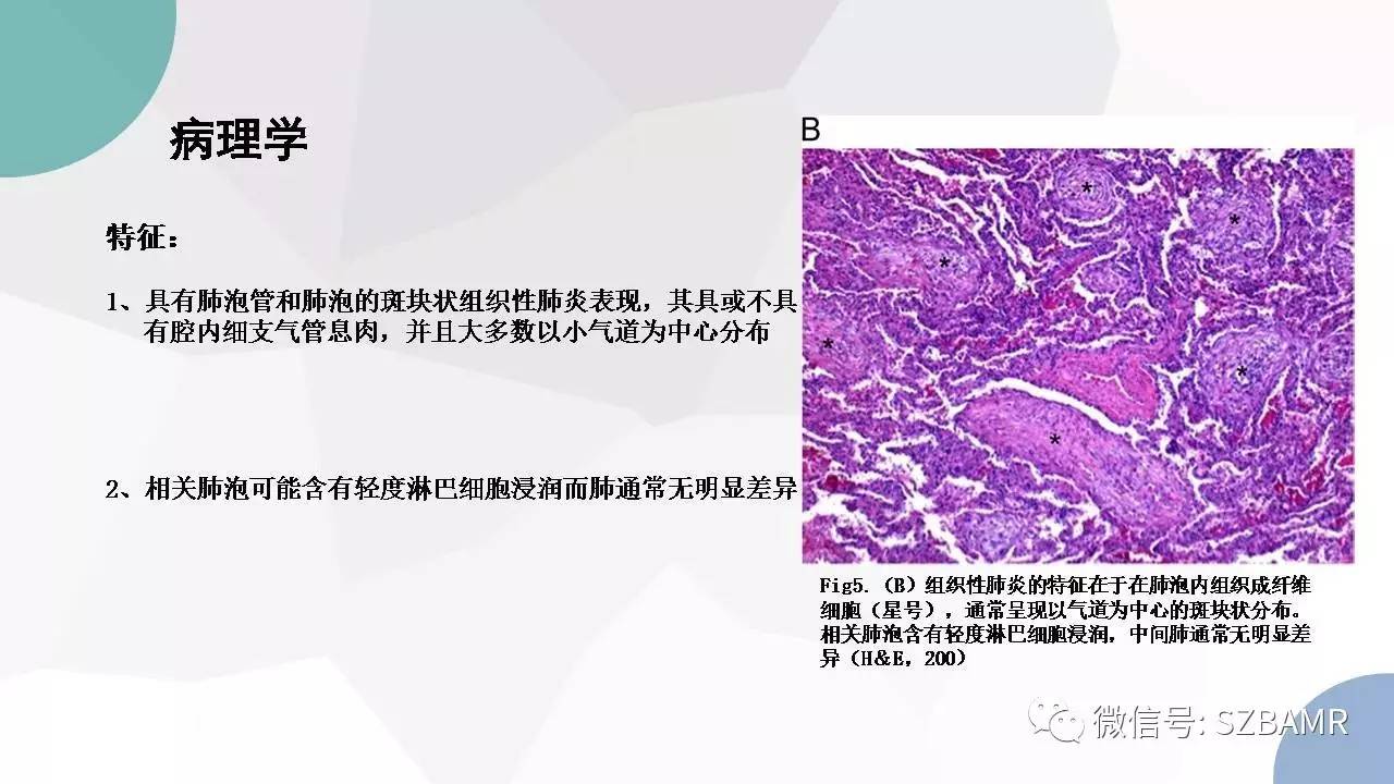 【PPT】特发性间质性肺炎的影像与病理