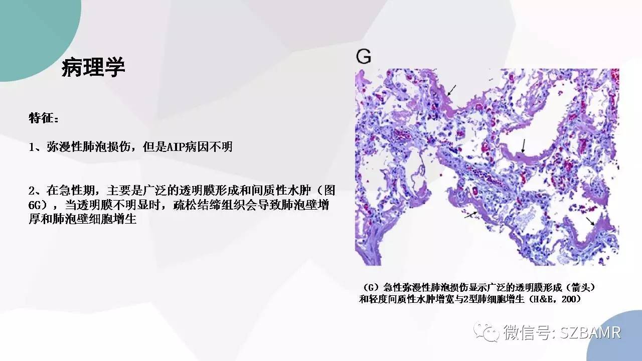 【PPT】特发性间质性肺炎的影像与病理