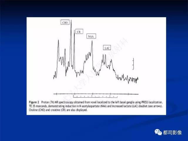 【PPT】新生儿胆红素脑病与糖代谢异常脑损伤影像表现