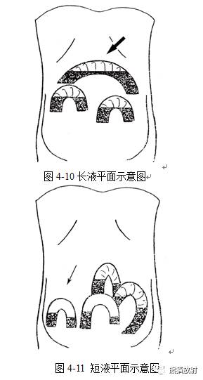 胃肠道急腹症必须搞清楚的几个问题 胃肠道急腹症必须搞清楚的几个问题