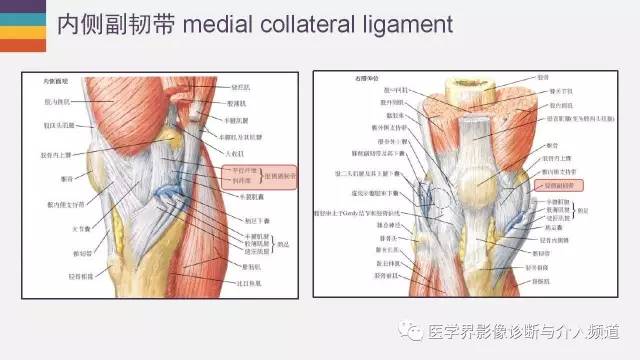 【PPT】膝关节内侧副韧带解剖及损失MR诊断