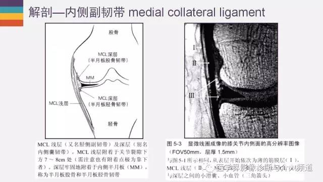 【PPT】膝关节内侧副韧带解剖及损失MR诊断