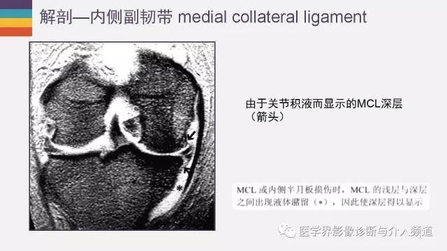 【PPT】膝关节内侧副韧带解剖及损失MR诊断
