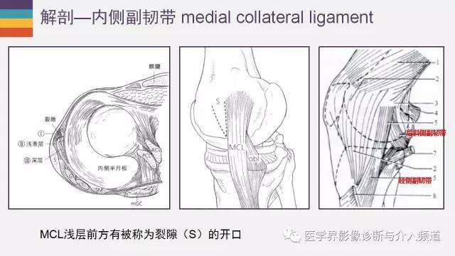 【PPT】膝关节内侧副韧带解剖及损失MR诊断