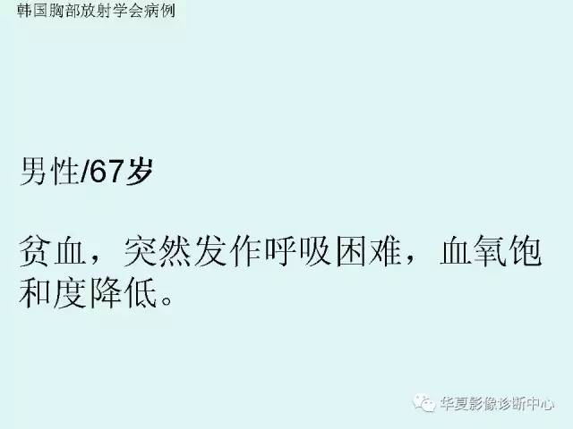 【PPT】输血相关急性肺损伤